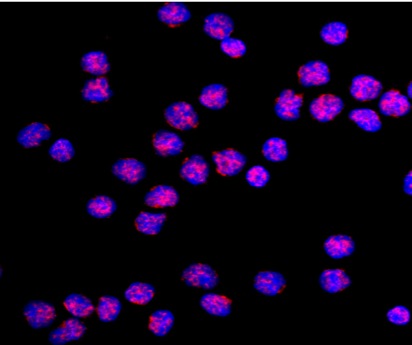 T lymphocytes: LINE1 transcripts in red